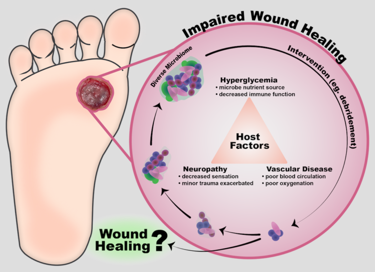 Wound Care