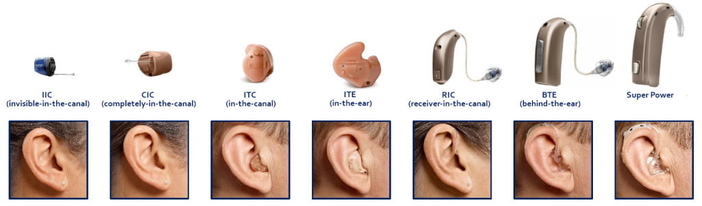 Types of hearing solutions